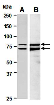 IL13 Receptor alpha 2 antibody