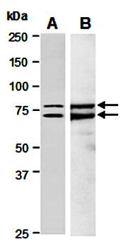 IL13RA2 (C) Antibody, Rabbit Polyclonal