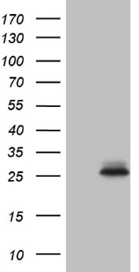 IL15 antibody