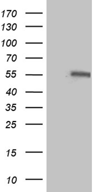 IL15RA antibody
