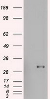 IL15RA antibody