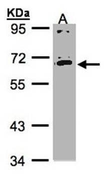 interleukin 17 receptor C isoform 1 precursor antibody