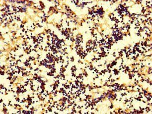 IL17A Antibody