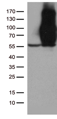 IL17B antibody