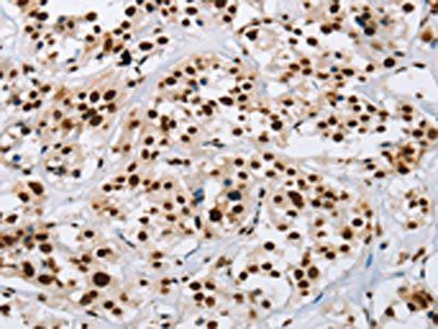 IL17C antibody