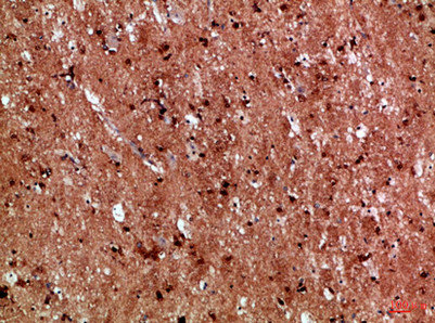 IL17D antibody