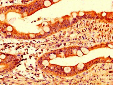 IL17F antibody