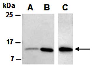 IL17F (vPairTM) Antibodies
