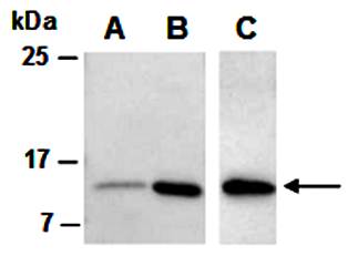 IL17F antibody pair