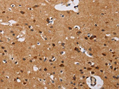 IL17RA Antibody