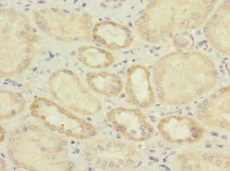 IL17RB Antibody