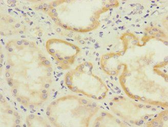 IL17RB Antibody