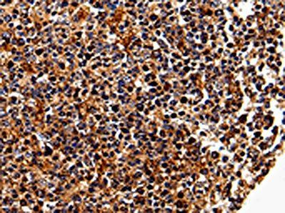 IL17RC antibody