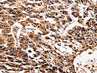 IL17RD Antibody