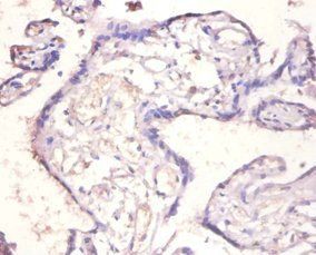 IL18BP Antibody