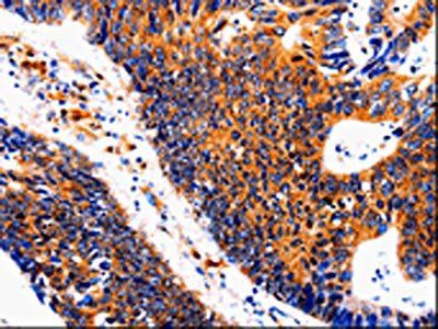 IL18BP Antibody