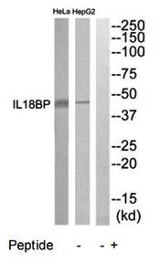 IL18BP antibody