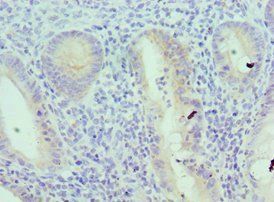 IL18RAP Antibody