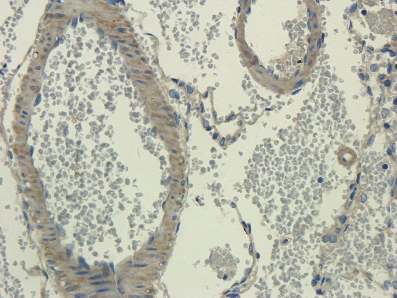 IL1 alpha antibody