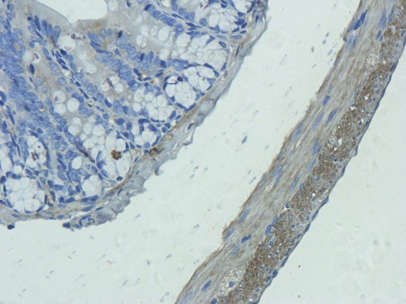 IL1 alpha Rabbit Polyclonal Antibody