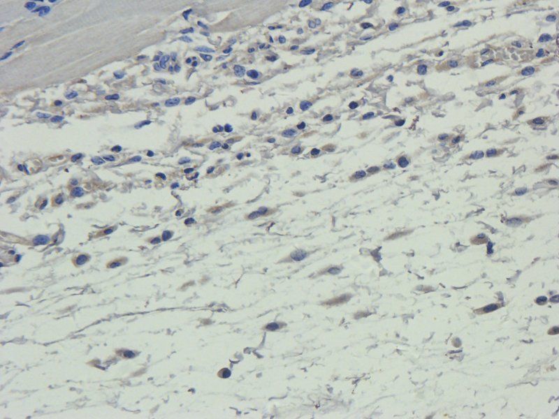 IL1 alpha Rabbit Polyclonal Antibody