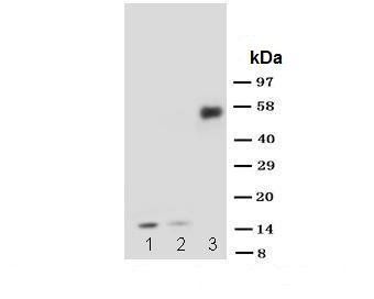 Anti-IL1 beta/IL1B Antibody