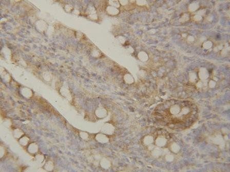 Anti-IL1 beta/IL1B Antibody