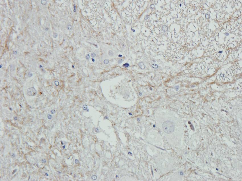 IL1 beta antibody