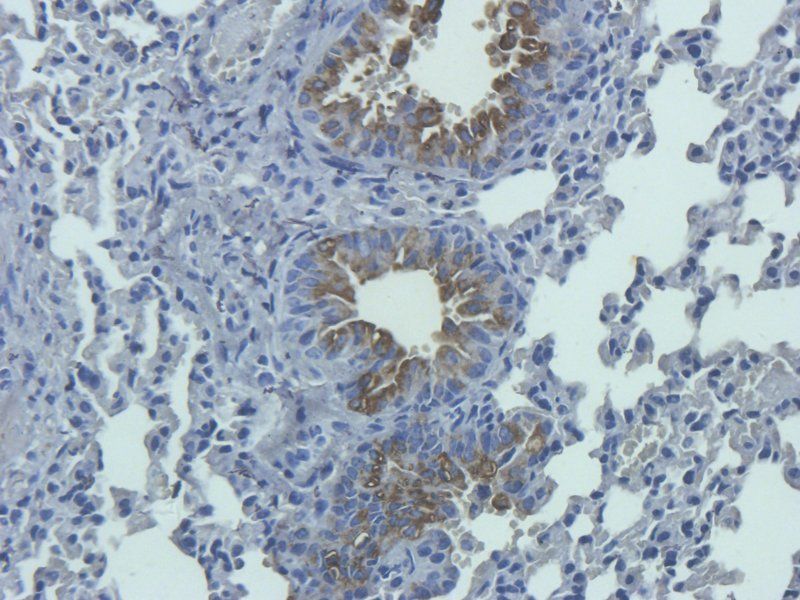 IL1 RA Rabbit Polyclonal Antibody