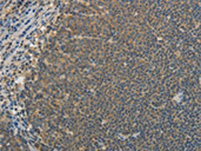 IL1B Antibody