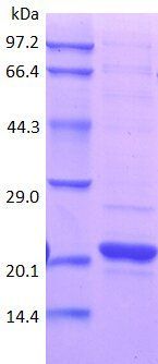 IL1B protein