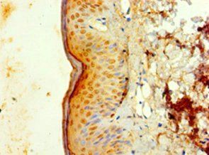 IL1F10 antibody