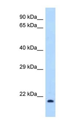 IL1RA antibody