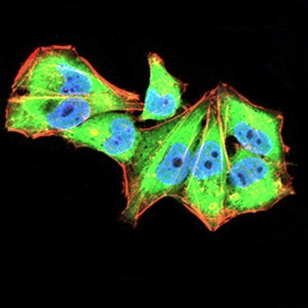 IL1RAPL1 Antibody