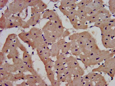 IL1RAPL1 Antibody