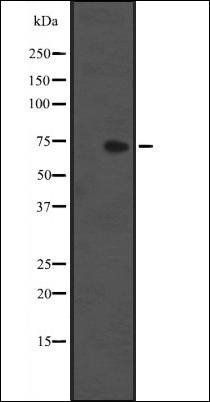 IL1RL1 antibody