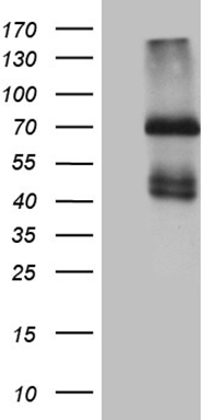IL2 Receptor beta (IL2RB) antibody