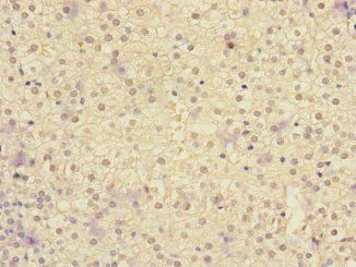 IL20RA Antibody