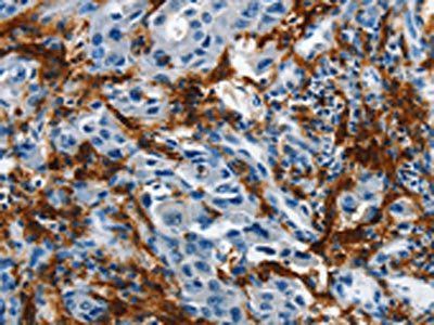 IL20RA Antibody