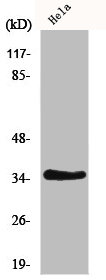 IL20RB antibody