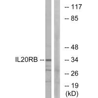 IL20RB antibody