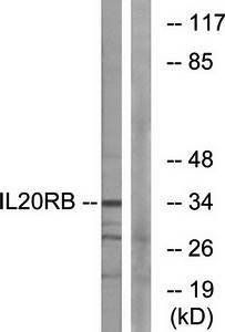 IL20RB antibody