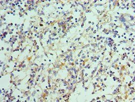 IL21 antibody