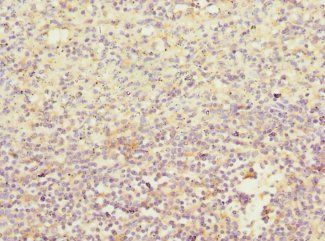 IL21R Antibody