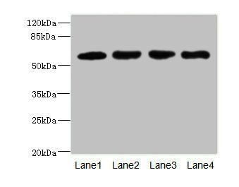 IL21R Antibody