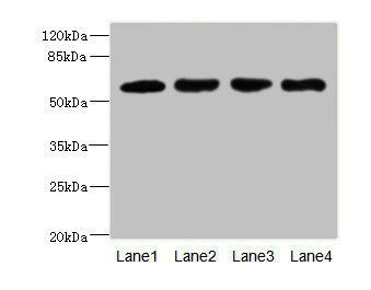 IL21R antibody