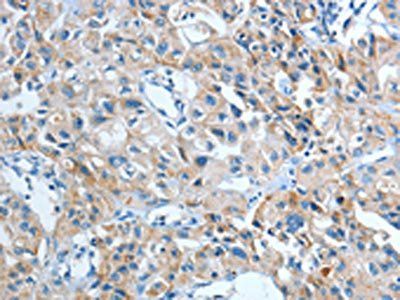 IL21R antibody