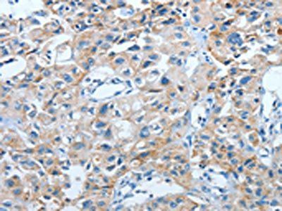 IL21R Antibody