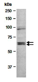 IL21 Receptor antibody