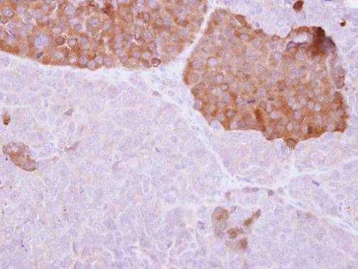 IL22 Receptor alpha 2 antibody